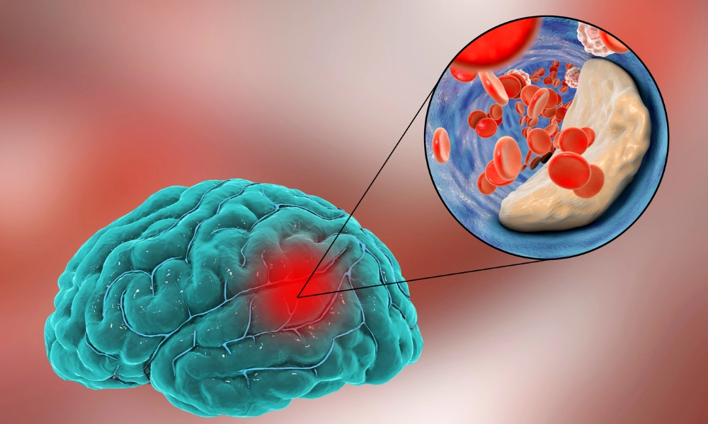 Bí Quyết Ăn Uống Cho Người Thiếu Máu Lên Não